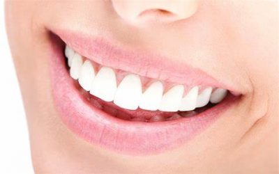 Los 8 alimentos que protegen los dientes