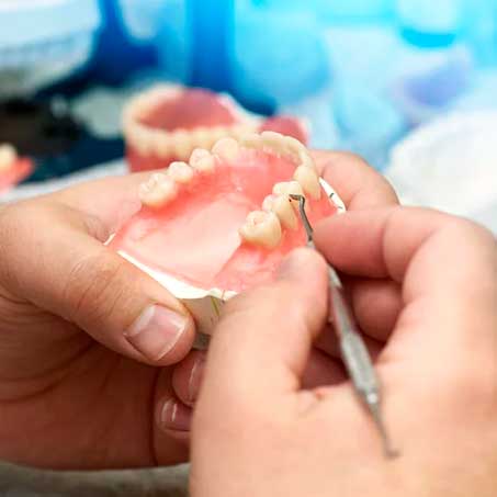 tratamientos prótesis dentales en LLeida Clínicas dental